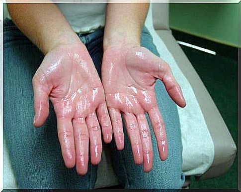 best natural remedies for hyperhidrosis