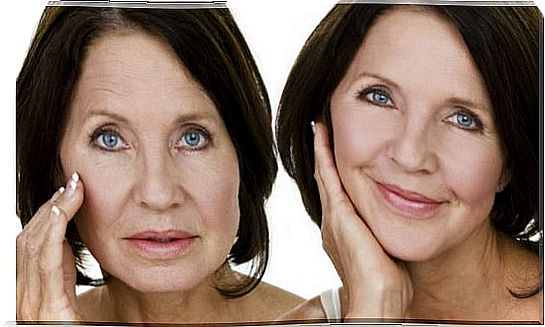 The effects of menopause symptoms on the skin